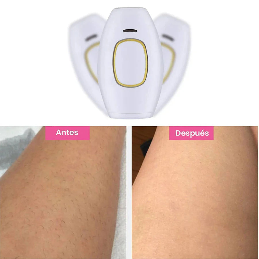 Dispositivo de depilación permanente LaserPulse PRO™